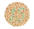 Color Blindness - Contact us in Marietta, GA for eye care.